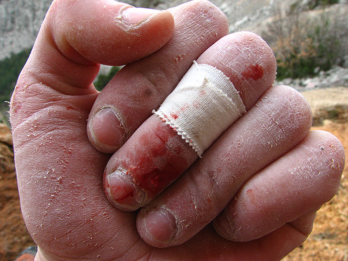 ...koja život znači!