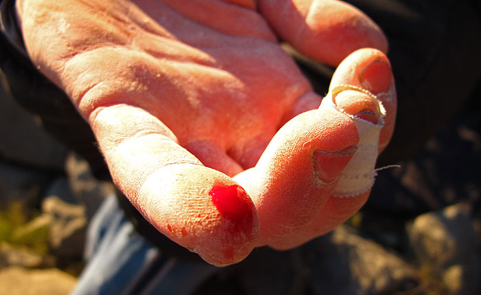 ... krvavi & oderani! Kilometri bandaže...