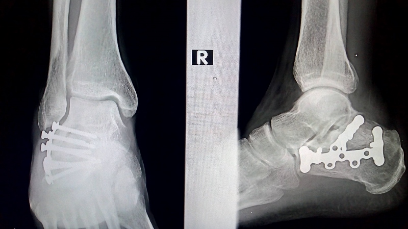 Samo hard core, samo Deda! Doktore Mihalj, valja li ovo?